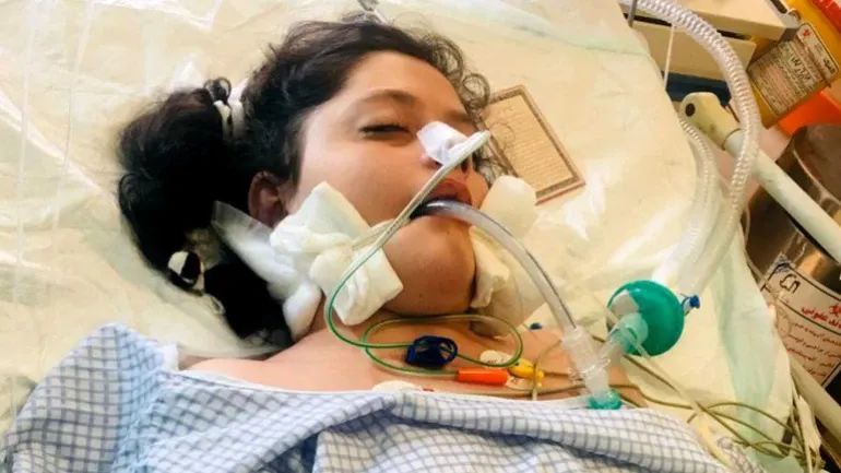 » 10. 伊朗一女子因未恰当佩戴头巾被捕后死亡，多地爆发示威游行据联合国新闻9月20日消息，22岁的伊朗女性玛莎·阿米尼（Mahsa Amini）由于未遵循严格的头巾佩戴要求，遭到伊朗“道德警察”逮捕，并在拘留期间死亡