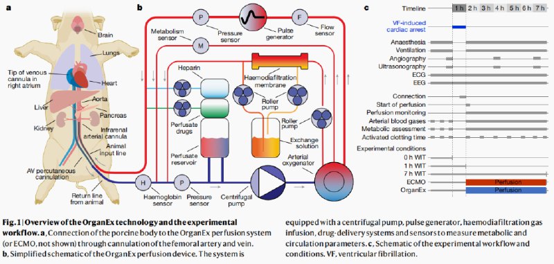 14. 死去活来？他们先是“复活”了猪脑，现在是全身其他重要器官2019年，耶鲁大学的内纳德·赛斯坦等人曾用再灌注手段成功地让猪脑“复活”了6小时