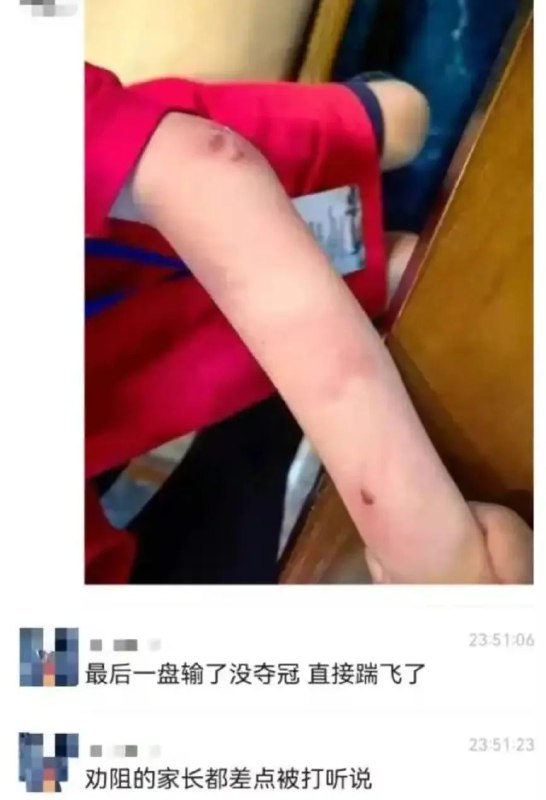 » 3、9岁围棋少年疑遭父亲家暴跳楼身亡近日，浙江杭州