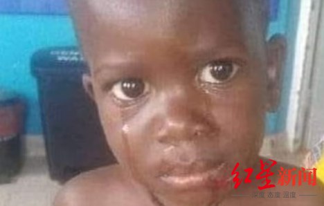 » 12、乌干达2岁幼童被河马吞下后又吐出，竟然活下来了近日，乌干达的一头河马将两岁儿童伊加（Paul Iga）吞下后，又将其吐出来